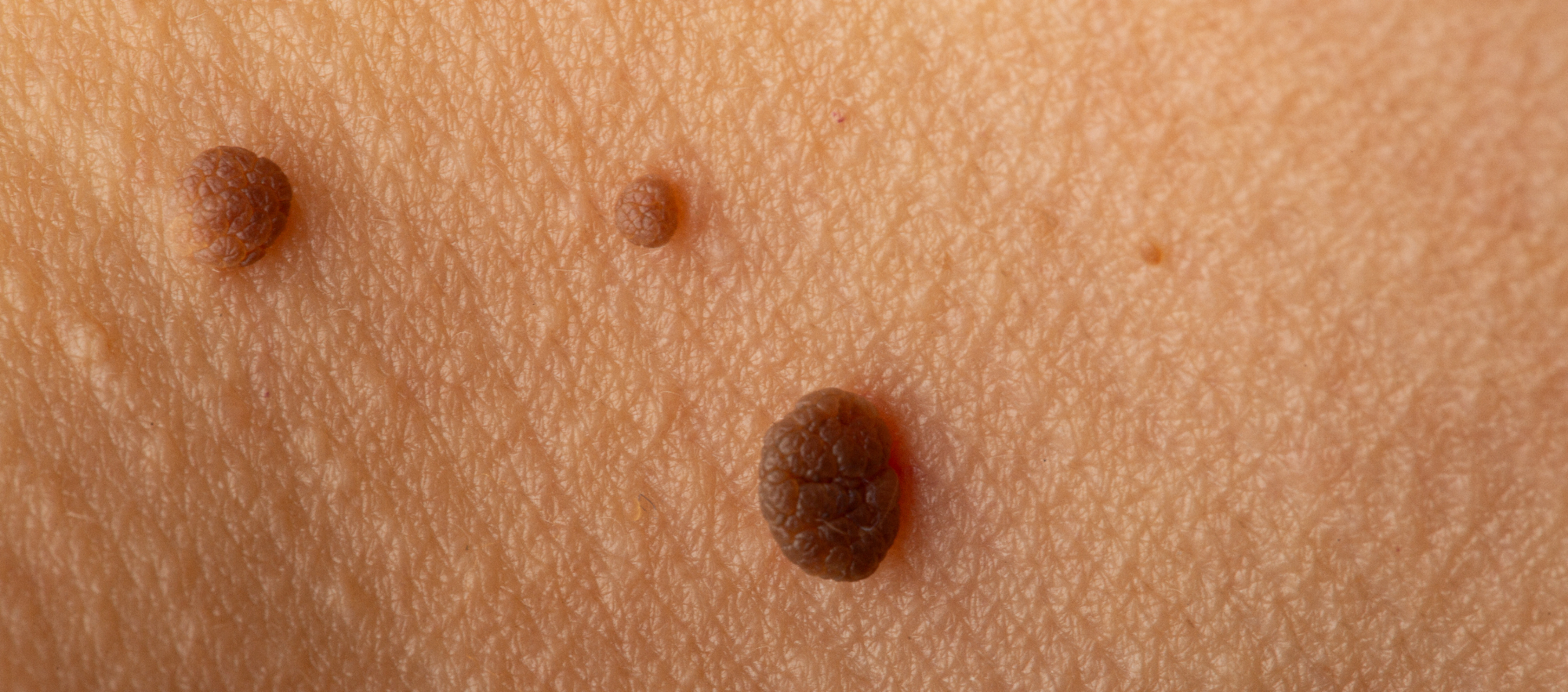 Dermatologija mi je še kako pomagala